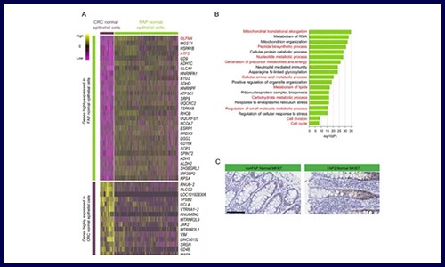 GUT 高分文章‖基因組測序 + 單細(xì)胞測序應(yīng)用于發(fā)病機(jī)制研究