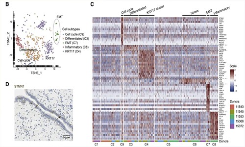 單細(xì)胞測(cè)序加速藥物研發(fā) | 藥物靶點(diǎn)發(fā)現(xiàn)及驗(yàn)證！