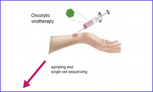 文獻(xiàn)解讀 | 應(yīng)用單細(xì)胞測序技術(shù)研究溶瘤病毒的治療作用機(jī)制