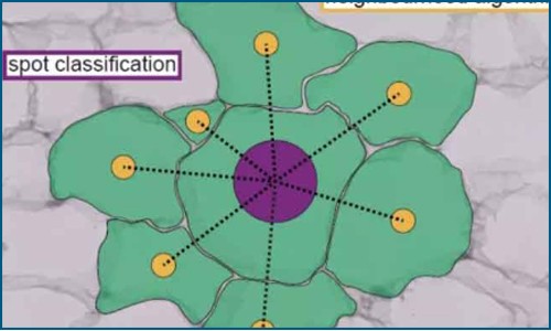 空間轉(zhuǎn)錄組聯(lián)合單細(xì)胞 RNA 測序技術(shù) | 揭示對(duì)胰島素有明顯敏感性的人類脂肪細(xì)胞亞群