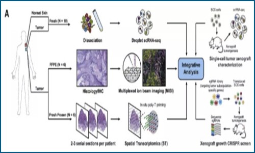 單細(xì)胞 + 空間轉(zhuǎn)錄組 | 多組學(xué)探究人鱗狀上皮癌腫瘤微環(huán)境