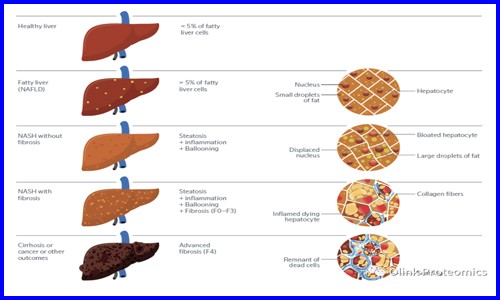 Nat Gen 干貨 |deCODE genetics 團(tuán)隊(duì)借助 Olink Explore 對(duì) NAFLD 患者進(jìn)行多組學(xué)研究