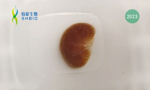 樣本指南 |FFPE 樣本空轉(zhuǎn)送樣指南