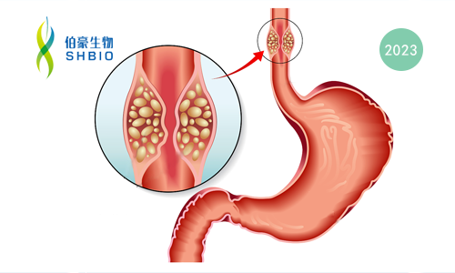 文獻(xiàn)解讀 | 食管癌的單細(xì)胞轉(zhuǎn)錄景觀及其對(duì)新輔助化療的調(diào)控