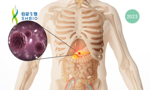 文獻(xiàn)解讀 | 單細(xì)胞測(cè)序揭示了在人類慢性胰腺炎中具有 CCR6-CCL20 串?dāng)_的獨(dú)特免疫微環(huán)