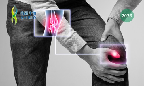 mRNA-seq 項(xiàng)目文章 | 靶向 KAT2A 通過表觀遺傳和代謝重編程抑制炎性巨噬細(xì)胞活化和類風(fēng)濕關(guān)節(jié)炎