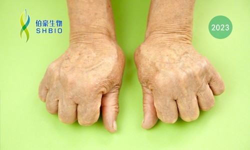 高分文獻一作分享會 | 時空組學技術助力發(fā)現(xiàn)類風濕關節(jié)炎疾病治療新靶點