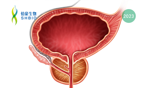 文獻解讀 | 在肺癌和前列腺癌中，通過下調(diào) SOX2 抑制 Exportin 1 從而抑制神經(jīng)內(nèi)分泌轉(zhuǎn)化