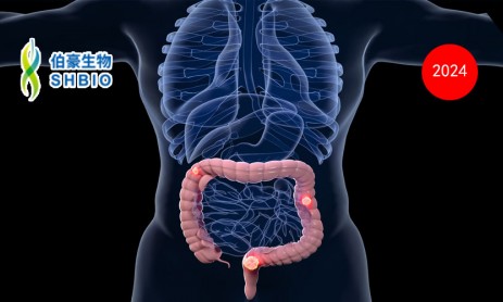 文獻(xiàn)解讀 | 單細(xì)胞轉(zhuǎn)錄組學(xué)分析揭示結(jié)直腸癌中異質(zhì)性腫瘤干細(xì)胞樣細(xì)胞及其器官特異性轉(zhuǎn)移特征