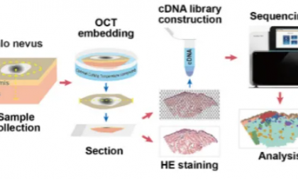 項(xiàng)目文章 | 暈痣黑色素細(xì)胞代謝異常與樹(shù)突狀細(xì)胞活化有關(guān)