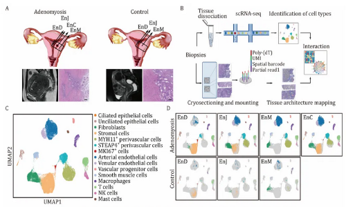 文獻解讀 | 整合單細胞 RNA 測序和空間轉錄組學破譯人類子宮腺肌癥的全面轉錄圖譜